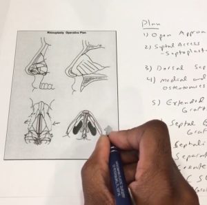 Dr. Narasimhan sketching nose as part of surgical plan